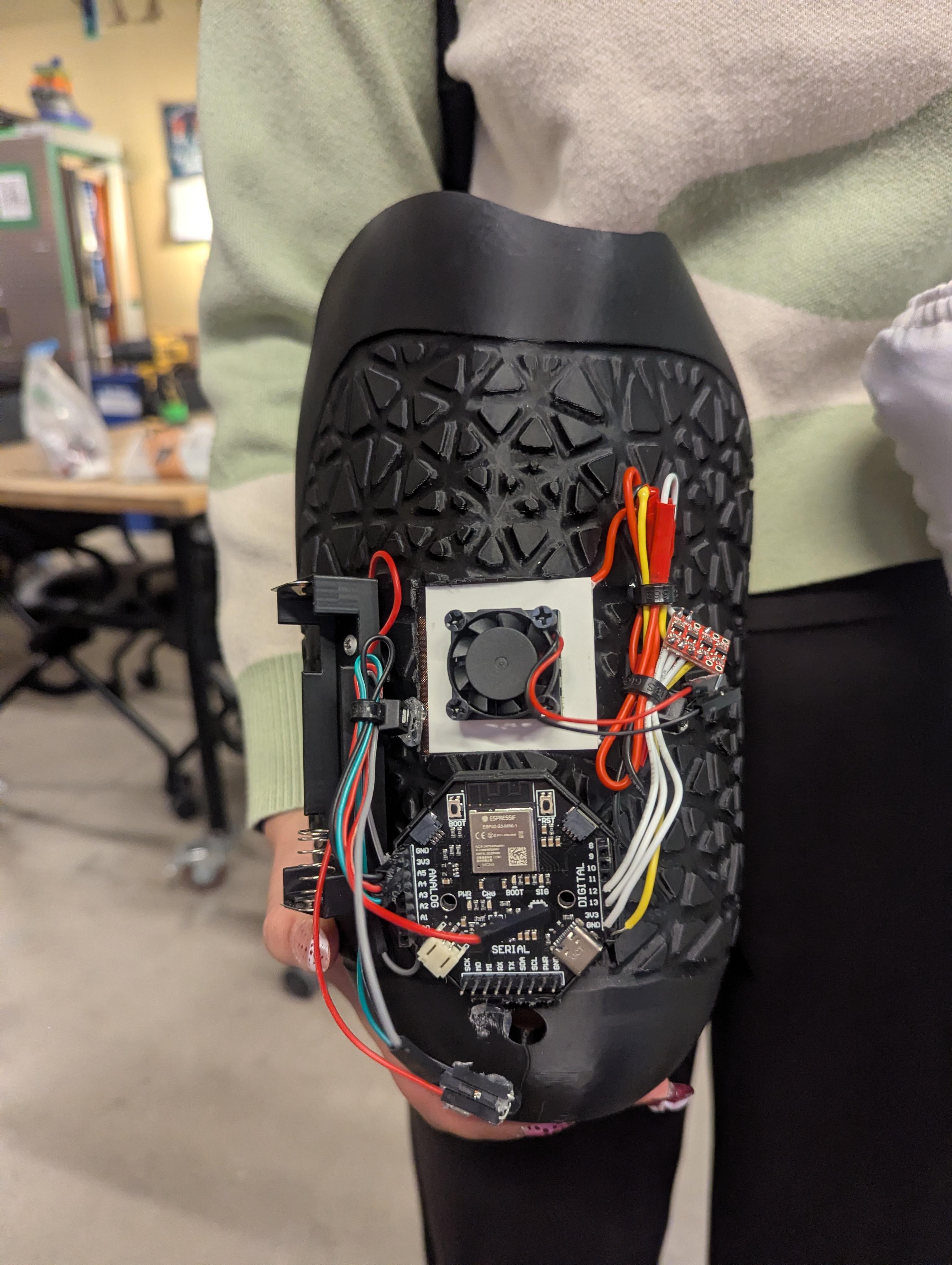 Smart A/C Prosthetic Leg